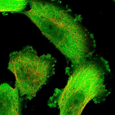 Immunocytochemistry/Immunofluorescence: HINT1 Antibody [NBP1-83257] - Immunofluorescent staining of human cell line U-251 MG shows localization to plasma membrane & cytosol.