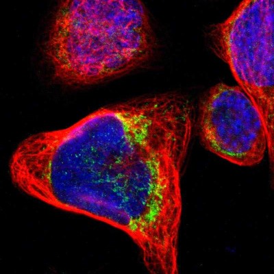 Immunocytochemistry/Immunofluorescence: OXCT1 Antibody [NBP1-82462] - Immunofluorescent staining of human cell line A-431 shows localization to mitochondria.
