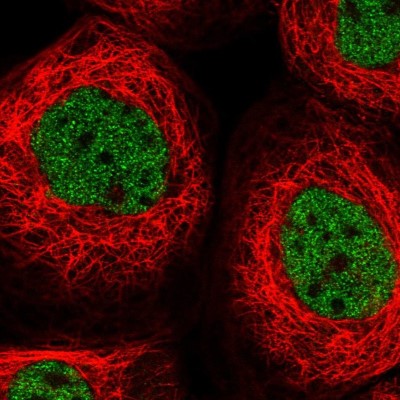 Immunocytochemistry/Immunofluorescence: OTUD6B Antibody [NBP1-85652] - Immunofluorescent staining of human cell line A-431 shows localization to nucleoplasm.