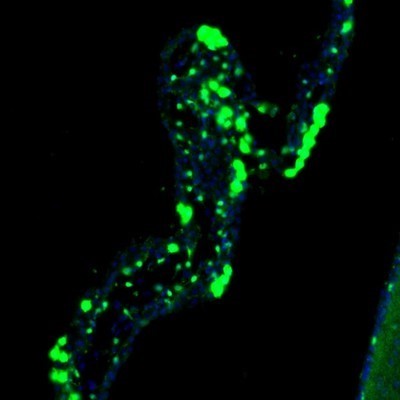 Immunocytochemistry/Immunofluorescence: LIAS Antibody [NBP1-82845] - Staining of mouse lateral ventricle shows nuclear labeling in a subset of cells in the choroid plexus and lateral ventricle wall.
