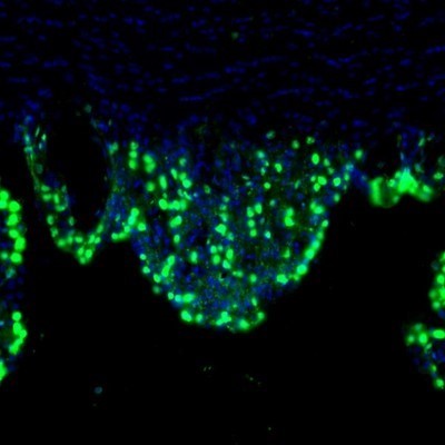 Immunocytochemistry/Immunofluorescence: LIAS Antibody [NBP1-82845] - Staining of mouse subfornical organ shows nuclear positivity in a subset of cells.