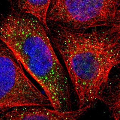 Immunocytochemistry/Immunofluorescence: BTG2 Antibody [NBP1-81215] - Immunofluorescent staining of human cell line A-431 shows localization to vesicles.