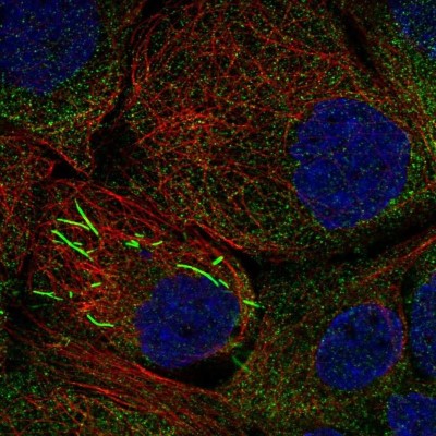 Immunocytochemistry/Immunofluorescence: IMP Dehydrogenase 2/IMPDH2 Antibody [NBP1-86177] - Staining of human cell line A-431 shows localization to cytosol & rods & rings.