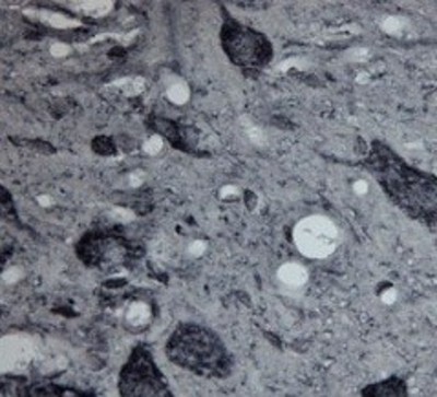 Immunohistochemistry-Paraffin: 5HT7 Receptor Antibody [NBP1-46598] - Rat spinal cord (paraffin section) using Rabbit antibody to internal region of 5HT7R receptor (Serotonin receptor 7R): whole serum at 1 : 200 dilution incubated overnight at 4C, developed with DAB/Ni.