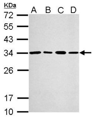 Western Blot: PA28 Activator gamma Subunit/PSME3 Antibody [NBP1-33498] -  Sample (30 ug of whole cell lysate) A: A549 B: H1299 C: HCT116 D: MCF-7 12% SDS PAGE, antibody diluted at 1:2000.