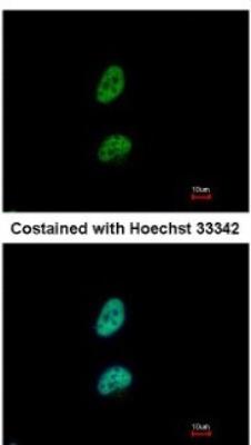 Immunocytochemistry/Immunofluorescence: PA28 Activator gamma Subunit/PSME3 Antibody [NBP1-33498] - Paraformaldehyde-fixed HeLa, using antibody at 1:500 dilution.