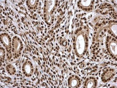 Immunohistochemistry-Paraffin: PA28 Activator gamma Subunit/PSME3 Antibody [NBP1-33498] - Paraffin-embedded mouse cervix. PSME3 antibody  diluted at 1:500.