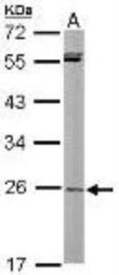 Western Blot: PA28 Activator gamma Subunit/PSME3 Antibody [NBP1-33498] -  Mouse liver (50 ug whole cell lysate) probed with NBP1-33498 diluted at 1:2000.