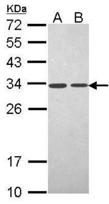 Western Blot: PA28 Activator gamma Subunit/PSME3 Antibody [NBP1-33498] - (30 ug of whole cell lysate) Lane A: A431 cell lystate, Lane B: H1299 cell lysate.  12% SDS PAGE at 1:1000 dilution.