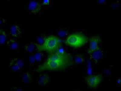 Immunocytochemistry/Immunofluorescence: IFIT1 Antibody (3G8) [NBP2-02340] - Staining of COS7 cells transiently transfected by pCMV6-ENTRY IFIT1.