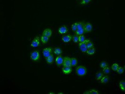 Immunocytochemistry/Immunofluorescence: IFIT1 Antibody (3G8) [NBP2-02340] - Immunofluorescent staining of HT29 cells using anti-IFIT1 mouse monoclonal antibody.