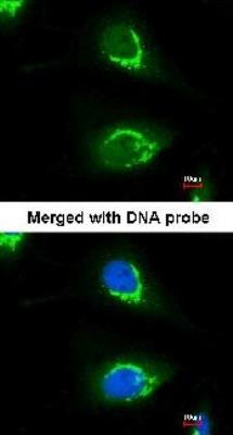 Immunocytochemistry/Immunofluorescence: Coatomer Subunit Delta Antibody [NBP1-32377] - analysis of HeLa, using COPD antibody at 1:200 dilution.