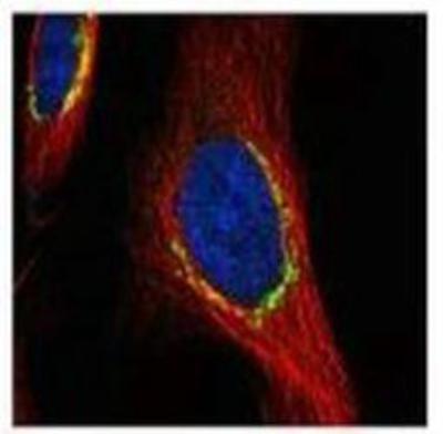 Immunocytochemistry/Immunofluorescence: Coatomer Subunit Delta Antibody [NBP1-32377] - Paraformaldehyde-fixed HeLa, using COPD(NBP1-32377) antibody (green) at 1:500 dilution. Alpha-tubulin filaments were labeled with NBP1-33273 (red) at 1:2500.