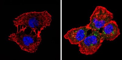 Immunocytochemistry/Immunofluorescence: Spectrin beta 1 Antibody (4C3) [NB300-574] - Analysis of Spectrin beta-1 (green) showing staining in the cytoplasm of A431 cells (right) compared to a negative control without primary antibody (left).