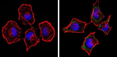 Immunocytochemistry/Immunofluorescence: Spectrin beta 1 Antibody (4C3) [NB300-574] - Analysis of Spectrin beta-1 (green) showing staining in the cytoplasm of Hela cells (right) compared to a negative control without primary antibody (left).