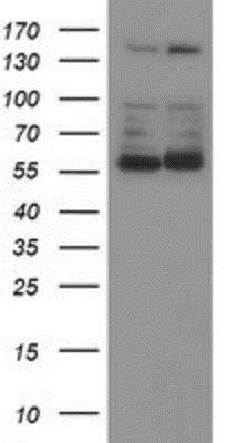 Western Blot: Phosphoribosyl Pyrophosphate Amidotransferase Antibody (1B8) [NBP2-02056] - HEK293T cells were transfected with the pCMV6-ENTRY control (Left lane) or pCMV6-ENTRY Phosphoribosyl Pyrophosphate Amidotransferase (Right lane) cDNA for 48 hrs and lysed. Equivalent amounts of cell lysates (5 ug per lane) were separated by SDS-PAGE and immunoblotted with anti-Phosphoribosyl Pyrophosphate Amidotransferase.