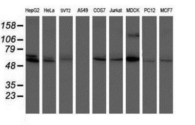 Western Blot: Phosphoribosyl Pyrophosphate Amidotransferase Antibody (1B8) [NBP2-02056] Analysis of extracts (35ug) from 9 different cell lines by usin g anti-Phosphoribosyl Pyrophosphate Amidotransferase monoclonal antibody (HepG2: human; HeLa: human; SVT2: mouse; A549: human; COS7: monkey; Jurkat: human; MDCK: canine; PC12: rat; MCF7: human).