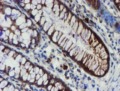 Immunohistochemistry-Paraffin: Phosphoribosyl Pyrophosphate Amidotransferase Antibody (1B8) [NBP2-02056] - Staining of paraffin-embedded Human colon tissue using anti-Phosphoribosyl Pyrophosphate Amidotransferase mouse monoclonal antibody.