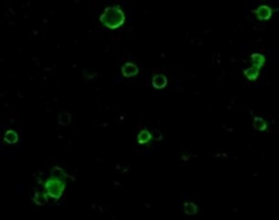 Immunocytochemistry/Immunofluorescence: TACE/ADAM17 Antibody [NBP1-77044] - HeLa cells.