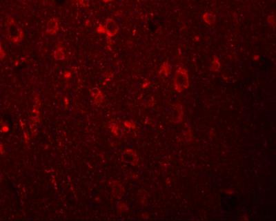 Immunocytochemistry/Immunofluorescence: EFHD2 Antibody [NBP1-77135] - Immunofluorescence of EFHD2 in human brain tissue with EFHD2 antibody at 20 ug/mL.