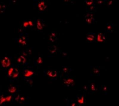 Immunocytochemistry/Immunofluorescence: PUMA Antibody [NBP1-76639] - K562 cells.