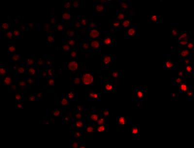Immunofluorescence: SnoN Antibody [NBP1-77306] - HeLa cells stained with SnoN antibody. Image from verified customer review.