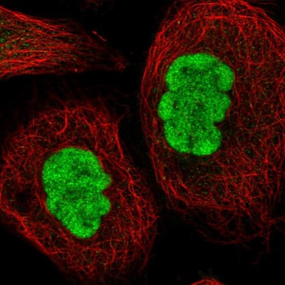 Immunocytochemistry/Immunofluorescence: METTL14 Antibody [NBP1-81392] - Immunofluorescent staining of human cell line A-431 shows localization to nucleoplasm.