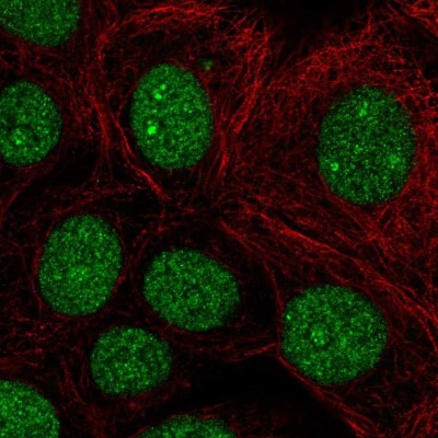 Immunocytochemistry/Immunofluorescence: BCL11B Antibody [NBP2-33549] - Staining of human cell line MCF7 shows localization to nucleus & nucleoli fibrillar center.