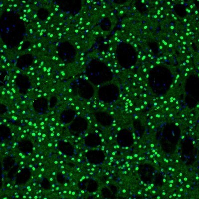 Immunocytochemistry/Immunofluorescence: BCL11B Antibody [NBP2-33549] - Staining of mouse basal forebrain shows nuclear positivity in neurons of caudate putamen.
