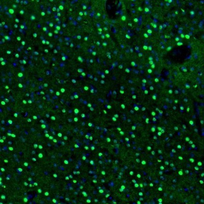 Immunocytochemistry/Immunofluorescence: BCL11B Antibody [NBP2-33549] - Staining of mouse nucleus accumbens shows nuclear positivity in neurons.