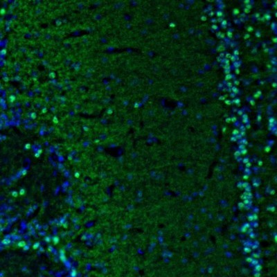 Immunocytochemistry/Immunofluorescence: BCL11B Antibody [NBP2-33549] - Staining of mouse olfactory bulb shows nuclear immunoreactivity in a subset of neurons.