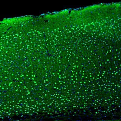 Immunocytochemistry/Immunofluorescence: BCL11B Antibody [NBP2-33549] - Staining of mouse parietal association cortex shows nuclear immunoreactivity in neurons.