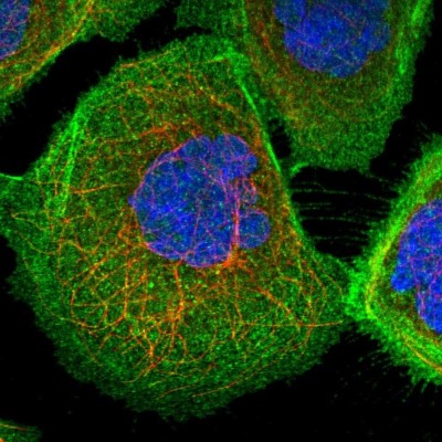 Immunocytochemistry/Immunofluorescence: PHACTR4 Antibody [NBP1-82267] - Immunofluorescent staining of human cell line A-431 shows localization to plasma membrane & cytosol.