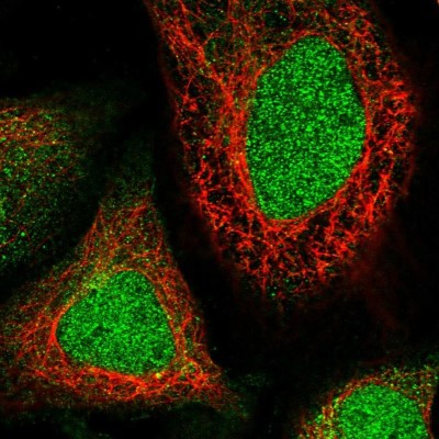 Immunocytochemistry/Immunofluorescence: WDR41 Antibody [NBP1-83812] - Immunofluorescent staining of human cell line U-2 OS shows localization to nucleus & cytosol.
