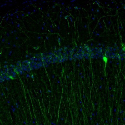 Immunocytochemistry/Immunofluorescence: RAP1GAP Antibody [NBP1-83002] - Staining of mouse hippocampus shows cytoplasmic positivity in a subset of interneurons in the CA1 area.