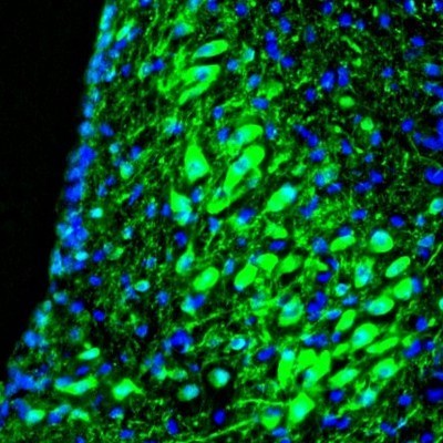 Immunocytochemistry/Immunofluorescence: RAP1GAP Antibody [NBP1-83002] - Staining of mouse midbrain shows strong immunoreactivity in locus coeruleus neurons.