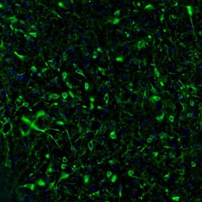 Immunocytochemistry/Immunofluorescence: RAP1GAP Antibody [NBP1-83002] - Staining of mouse hypothalamus shows positivity in neuronal cell bodies and processes in the lateral preoptic area.