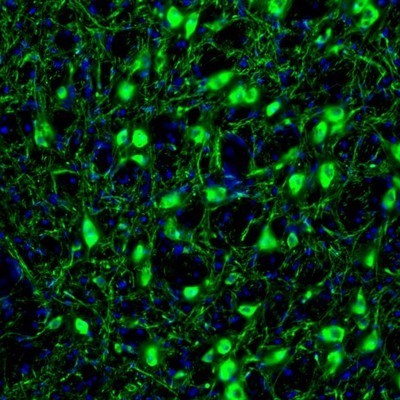 Immunocytochemistry/Immunofluorescence: RAP1GAP Antibody [NBP1-83002] - Staining of mouse globus pallidus shows strong cytoplasmic immunoreactivity in neurons.