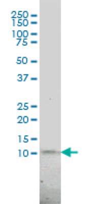 Western Blot: PCNA associated factor Antibody (3C11-1F11) [H00009768-M01] - Western Blot analysis of KIAA0101 expression in JAR ( Cat # L003V1 ).
