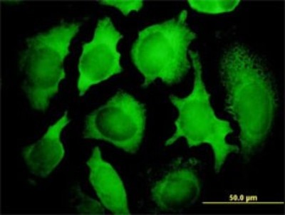 Immunocytochemistry/Immunofluorescence: PCNA associated factor Antibody (3C11-1F11) [H00009768-M01] - Analysis of monoclonal antibody to KIAA0101 on HeLa cell. Antibody concentration 10 ug/ml.