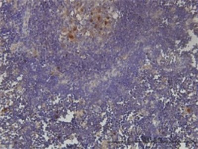 Immunohistochemistry-Paraffin: PCNA associated factor Antibody (3C11-1F11) [H00009768-M01] - Analysis of monoclonal antibody to KIAA0101 on formalin-fixed paraffin-embedded human lymph node tissue. Antibody concentration 3 ug/ml.