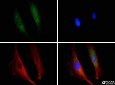 Immunocytochemistry/Immunofluorescence: DISC1 Antibody [NB110-40773] - DISC1 antibody was tested in PC-12 cells at 1:100 with Dylight 488 (green). Nuclei and alpha-tubulin were counterstained with DAPI (blue) and Dylight 549 (red).