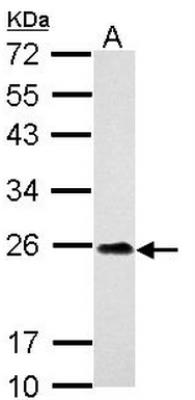 Western Blot: C9orf72 Antibody [NBP2-15656] - A: U87-MG