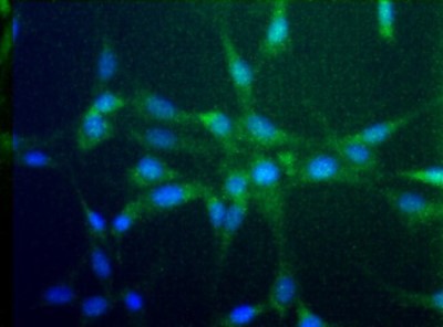Immunocytochemistry/Immunofluorescence: CCR2 Antibody [NBP1-48338] - Analysis of CCR2 in NIH/3T3 cells