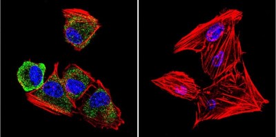 Immunocytochemistry/Immunofluorescence: uNOS Antibody (NOS-3F7-B11 B5) [NB120-2801] - Cells were grown on chamber slides and fixed with formaldehyde prior to staining. Cells were probed without (control) or with a uNOS monoclonal antibody at a dilution of 1:20 overnight at 4 C, washed with PBS and incubated with a DyLight-488 conjugated secondary antibody and nuclei with DAPI (blue) is shown.