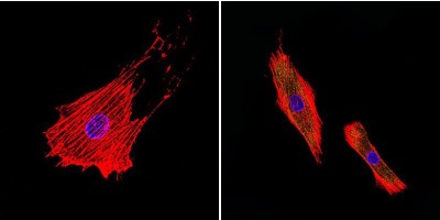 Immunocytochemistry/Immunofluorescence: uNOS Antibody (NOS-3F7-B11 B5) [NB120-2801] - Formalin-fixed cells were permeabilized with 0.1% Triton X-100 in TBS for 5-10 minutes at room temperature and blocked with 3% BSA-PBS for 30 minutes at room temperature. Cells were probed with a uNOS monoclonal antibody at a dilution of 1:20 and incubated overnight in a humidified chamber. Cells were washed with PBST and incubated with a DyLight-conjugated secondary antibody for 45 minutes at room temperature in the dark. F-actin (red) was stained with a fluorescent phalloidin and nuclei (blue) were stained with DAPI.