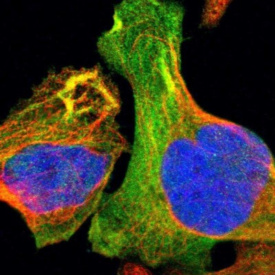 Immunocytochemistry/Immunofluorescence: Tropomodulin 3 Antibody [NBP1-86870] - Immunofluorescent staining of human cell line U-2 OS shows localization to cytosol & actin filaments.