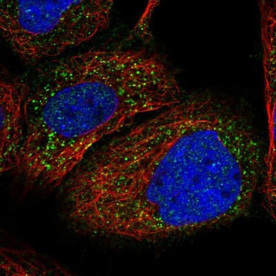 Immunocytochemistry/Immunofluorescence: PEX1 Antibody [NBP1-80577] - Staining of human cell line A-431 shows positivity in vesicles.