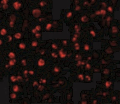 Immunocytochemistry/Immunofluorescence: ATF6 Antibody [NBP1-76675] - Immunofluorescence of ATF6 in MCF7 cells with ATF6 antibody at 10 ug/mL.