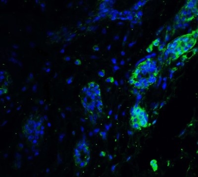 Immunocytochemistry/Immunofluorescence: ATF6 Antibody [NBP1-76675] - Staining of ATF6 in human breast tissue with ATF6 antibody at 20 ug/ml.
